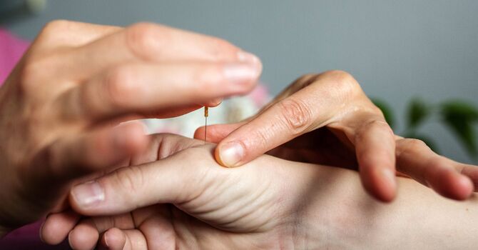 Facial Acupuncture