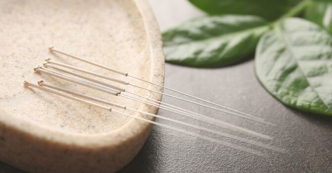 Acupuncture - Balance and Reset